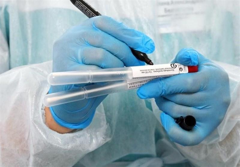 روسیه، استفاده از پلاسمای خون بیماران بهبود یافته در درمان کرونا
