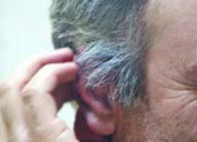 حرف های مفید در باره موهای سفید